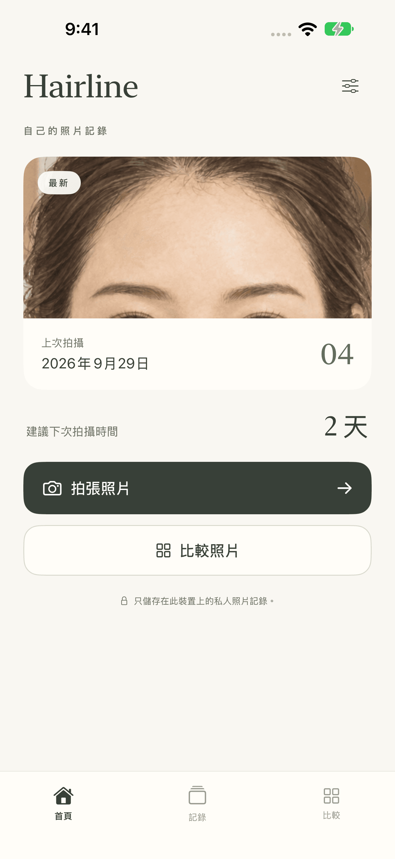 照自己的步調，記錄髮際線照片。