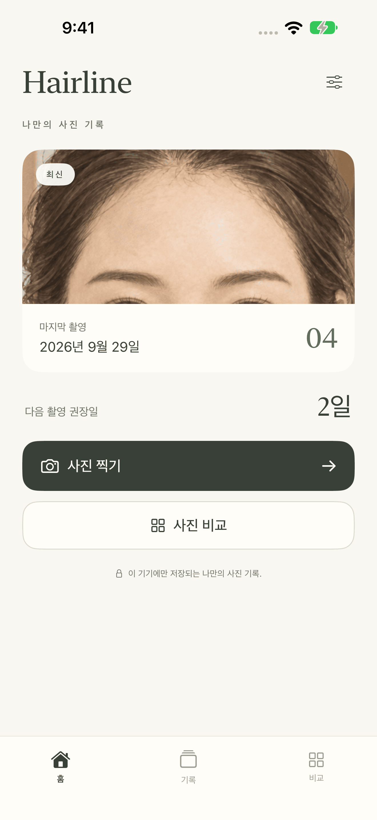 내 속도로 남기는 헤어라인 사진 기록.